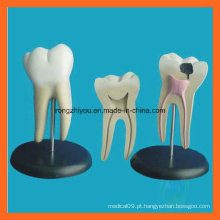 Modelo gigante de dentes odontológicos anatômicos molares